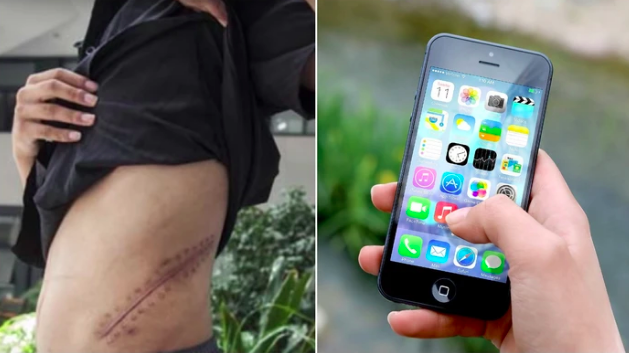 Nastolatek, który sprzedał nerkę za iPhone