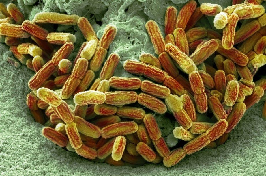 Legionella w Rzeszowie: 5 ofiar śmiertelnych