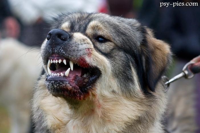 Pies zaatakował - dziecko straciło dwa palce
