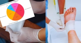 Trudno gojące się rany. Cichy problem milionów Polaków