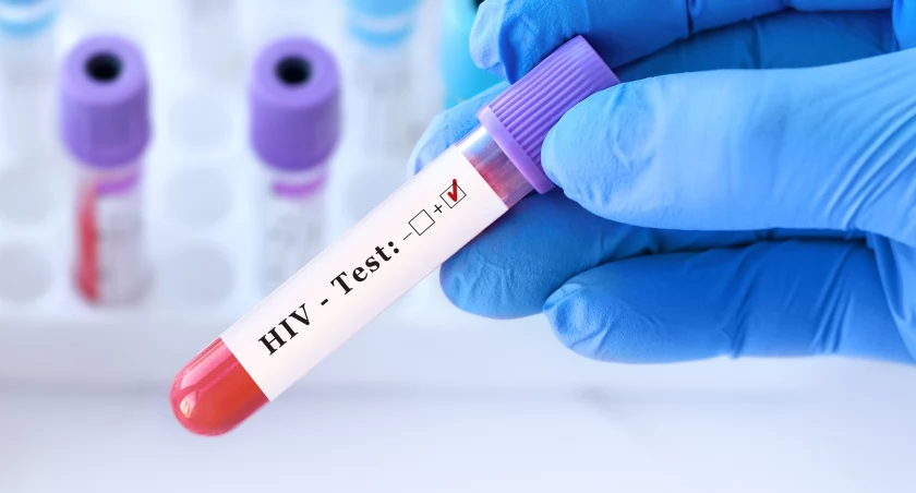 Ponad 120 nowych zakażeń HIV we Wrocławiu!