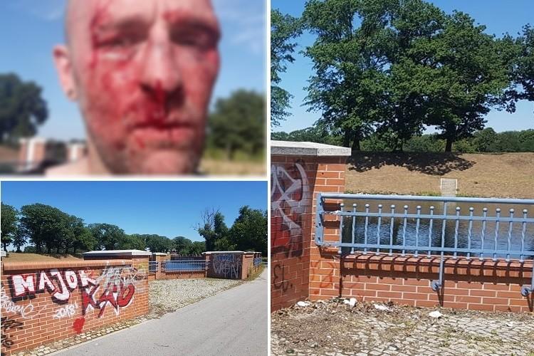 Podejrzany o pobicie Przemysława Witkowskiego z zarzutami