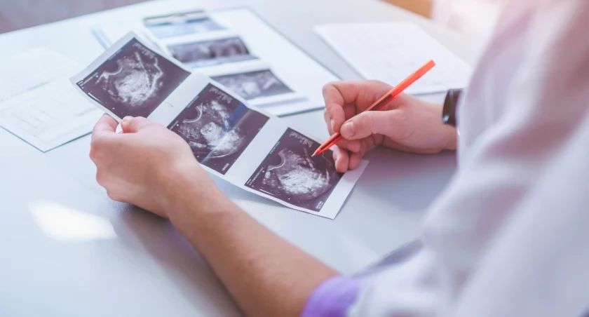 Wrocław kończy dopłacać do in vitro. Do tej pory wydano na ten program 4,5 mln złotych