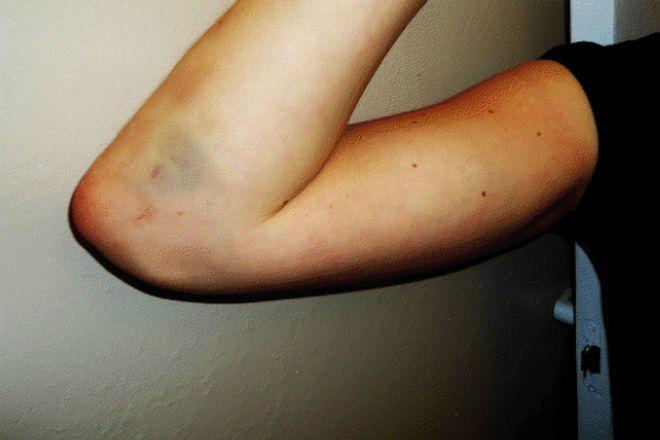 Kobieta pobita przez kontrolera biletów. MPK: zachowanie odbiegało od procedur 