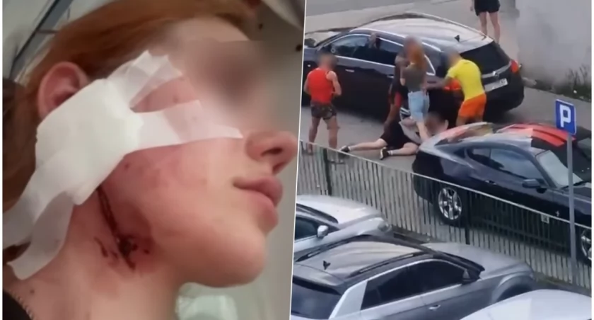 Brutalne pobicie we Wrocławiu. Trzech osiłków skatowało mężczyznę i kobietę. Bo 