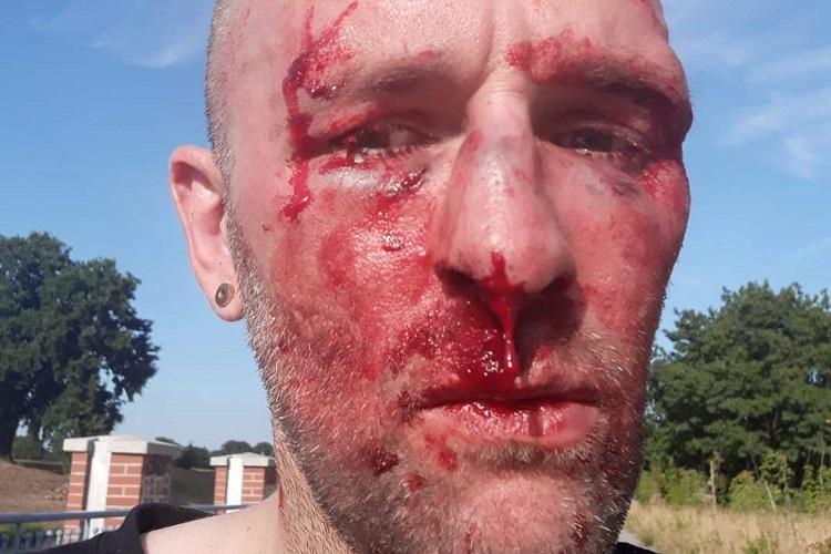 Rząd: „Atak we Wrocławiu był wyjątkowo barbarzyński”