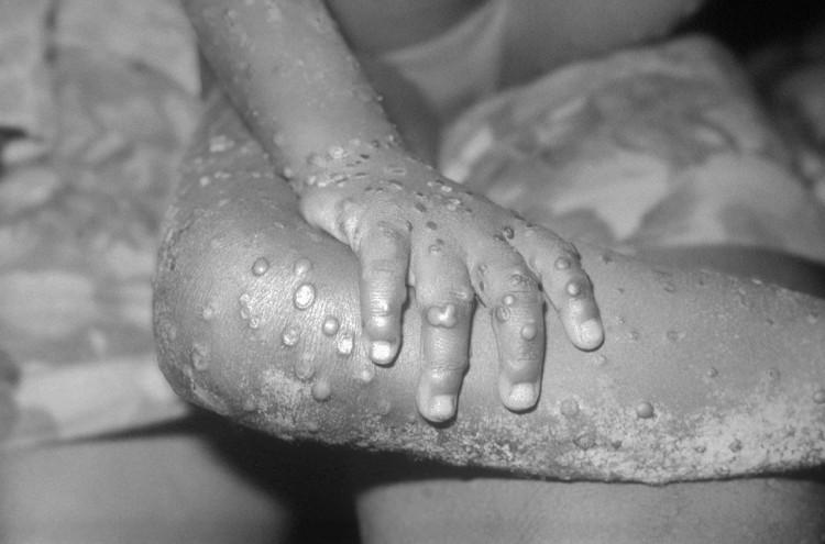 Pamiętacie jeszcze covid-19? Rząd właśnie przygotował przepisy na nową epidemię