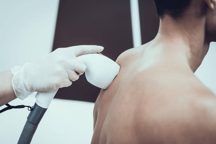 Depilacja laserowa – zobacz odpowiedzi na najczęściej zadawane pytanie