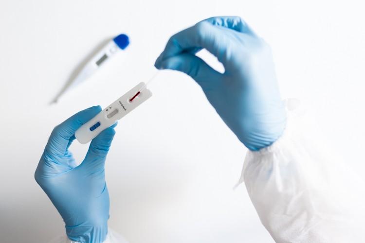 Test na COVID-19. Co należy zrobić, aby wykonać test na koronawirusa?