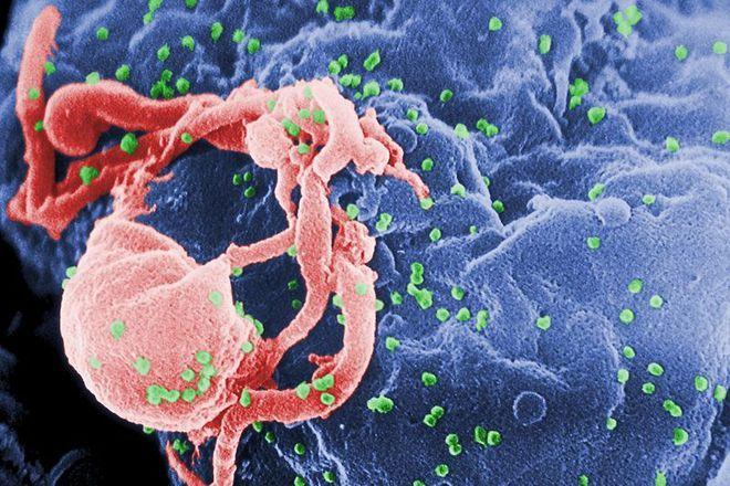 Wrocław i Dolny Śląsk w czołówce zakażonych HIV i chorych na AIDS