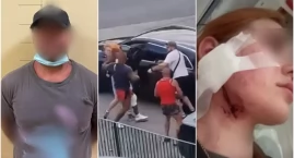 Policja zatrzymała dwóch bandytów, którzy brutalnie &hellip;