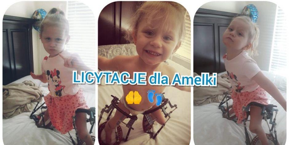 Mała Amelka liczy na Was! Licytujcie i pomagajcie!