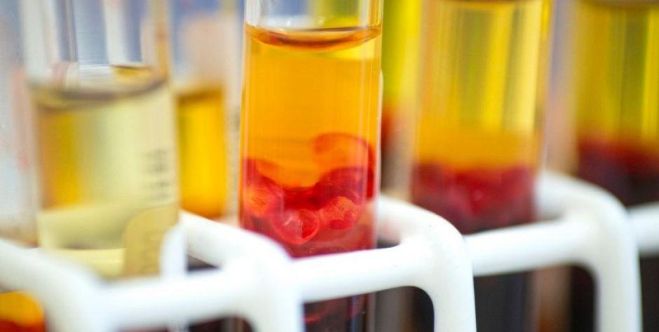 Powiat łosicki: Cztery osoby hospitalizowane z powodu podejrzenia zakażeniem
