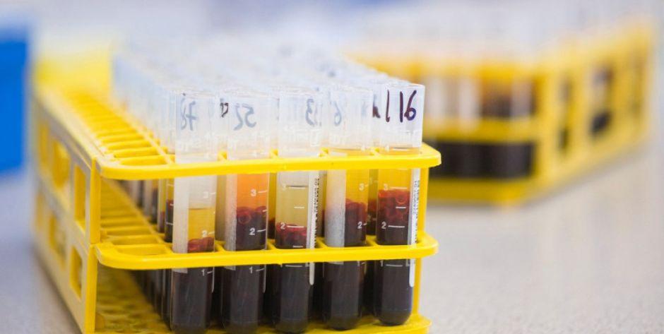 Aktualna sytuacja epidemiologiczna w regionie