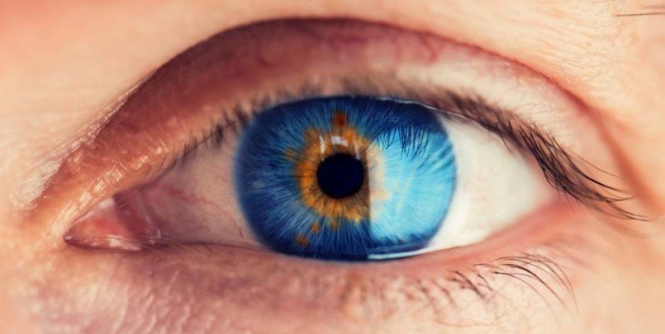Operacja zaćmy po laserowej korekcji wzroku
