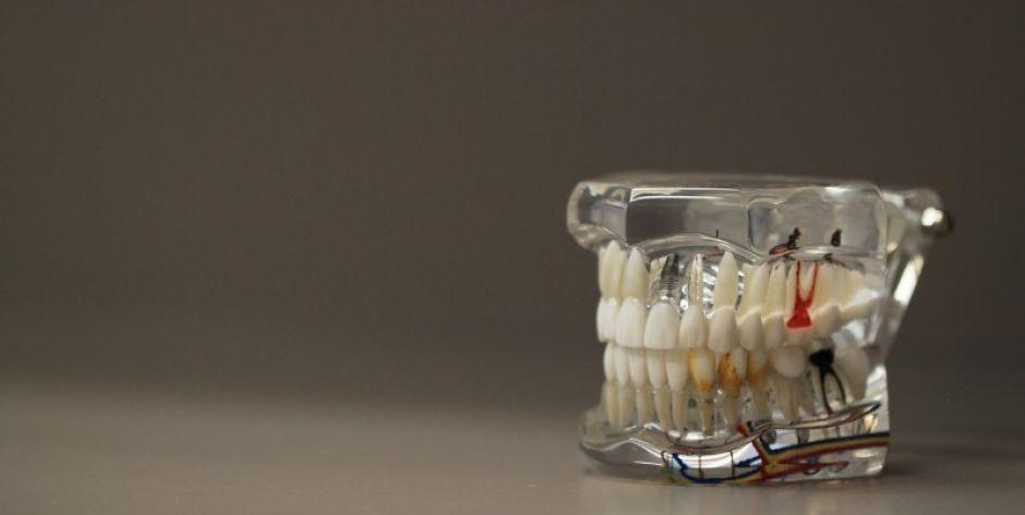 Jak działa irygator dentystyczny?