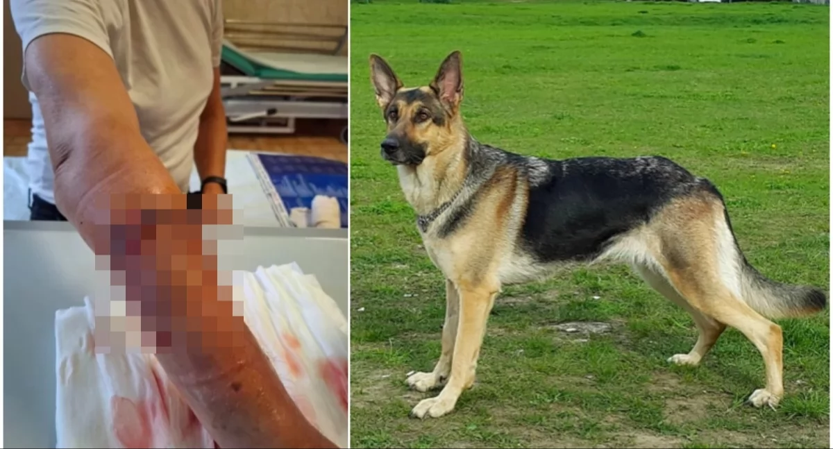 Owczarek niemiecki rzucił się na mężczyznę i dotkliwie go pogryzł (foto)
