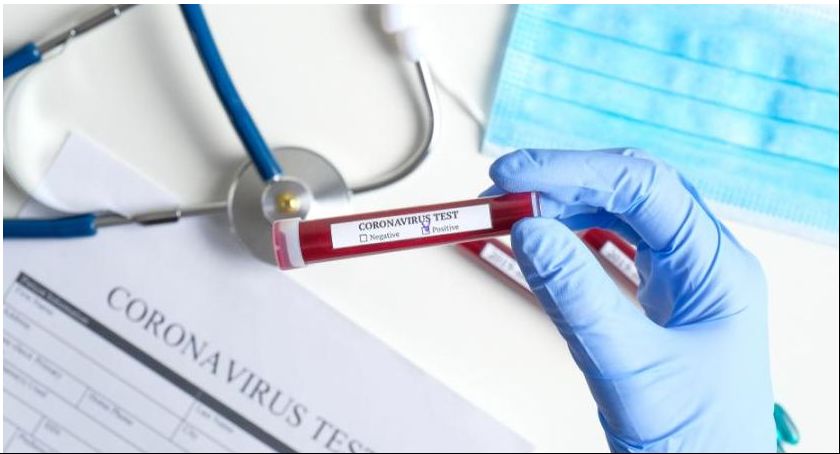 Koszty testów na obecność wirusa SARS-CoV-2 pokryje NFZ