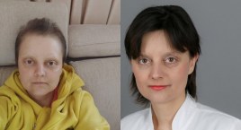 Pomóżmy Ani! Ona chce żyć i dalej pomagać innym a brakuje jeszcze ponad 90 tys. zł!