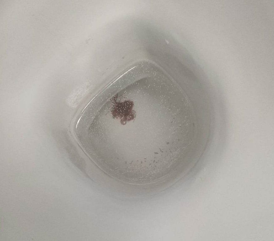 Czerwone nitkowate robaki w muszli klozetowej. Dobrze, że nie pod prysznicem. Czy to rurecznik?