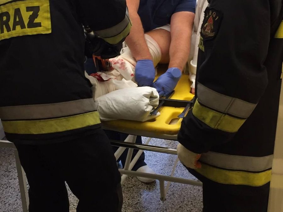 Strażacy w akcji przy stole operacyjnym. Pacjent miał kawałek ogrodzenia w nodze