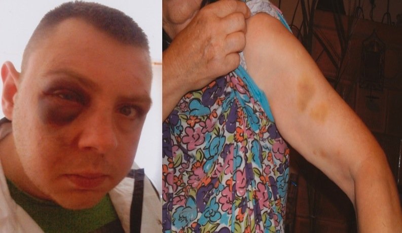Oskarżają policję o pobicie. Prokuratura wyjaśnia sprawę