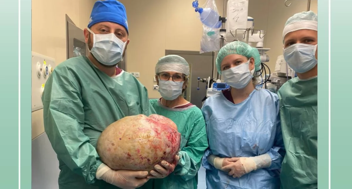 Gigantyczny guz wycięty w elbląskim szpitalu