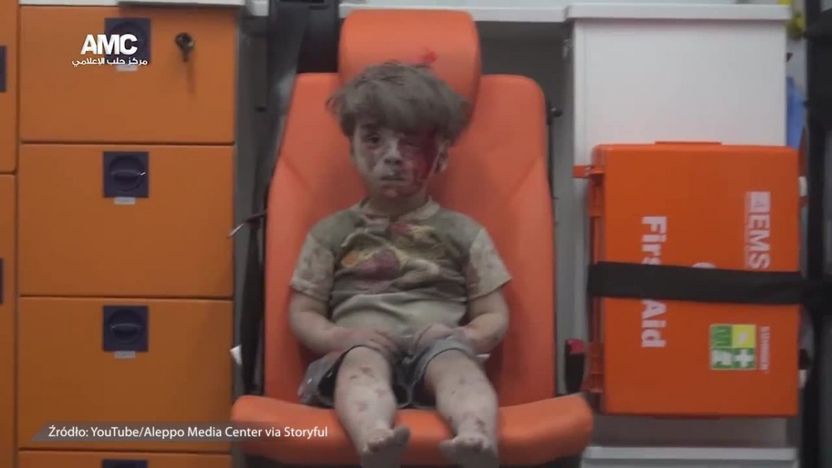 Wstrząsające zdjęcia chłopca który ucierpiał podczas bombardowania w Aleppo