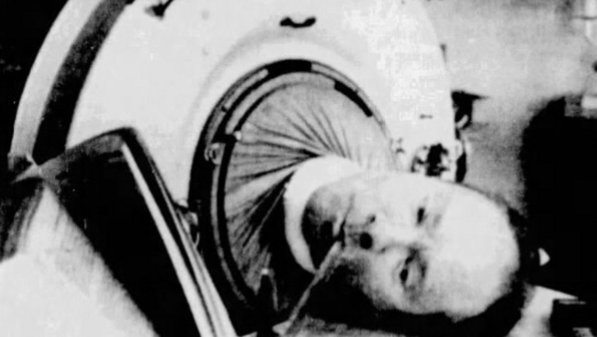 Zmarł chory na polio człowiek, który przez ponad 70 lat żył w 
