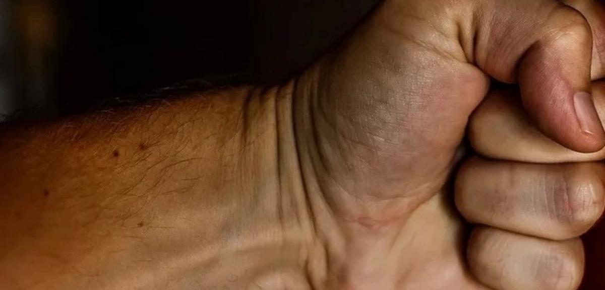 Bił żonę pięściami po głowie. Sprawca objęty dozorem