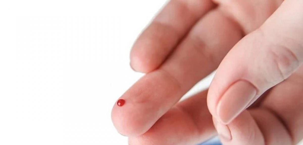 Bezpłatne testy na obecność wirusa HCV. Sprawdź swoją wątrobę.