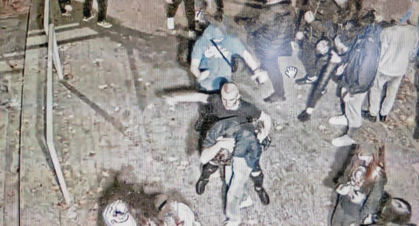 Policja poszukuje sprawców pobicia 18-latka! Młody mężczyzna trafił do szpitala