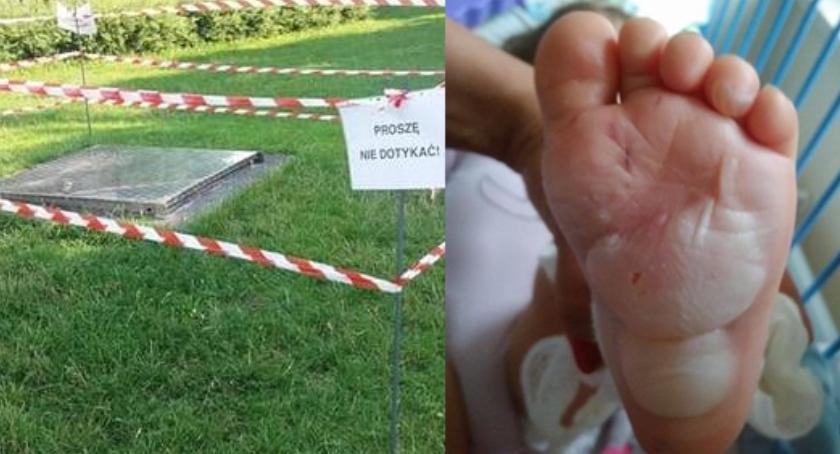 2-letnie dziecko poparzone na Placu Wodnym w Legionowie
