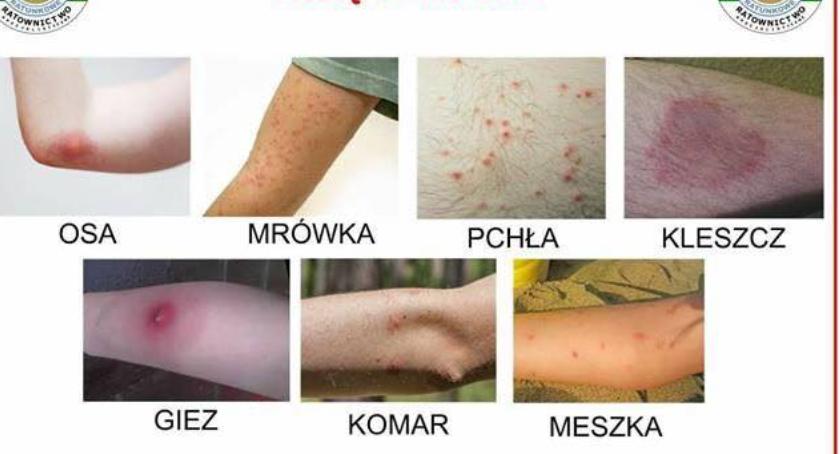 Sezon na ukąszenia. Bądźcie ostrożni!