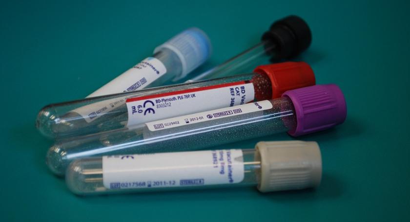 Przebadaj się. Anonimowe i darmowe testy na HIV i HCV. 