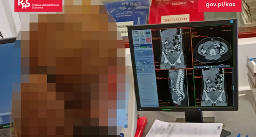 Milion złotych w… żołądku i plecaku. Przemytniczka zatrzymana na lotnisku