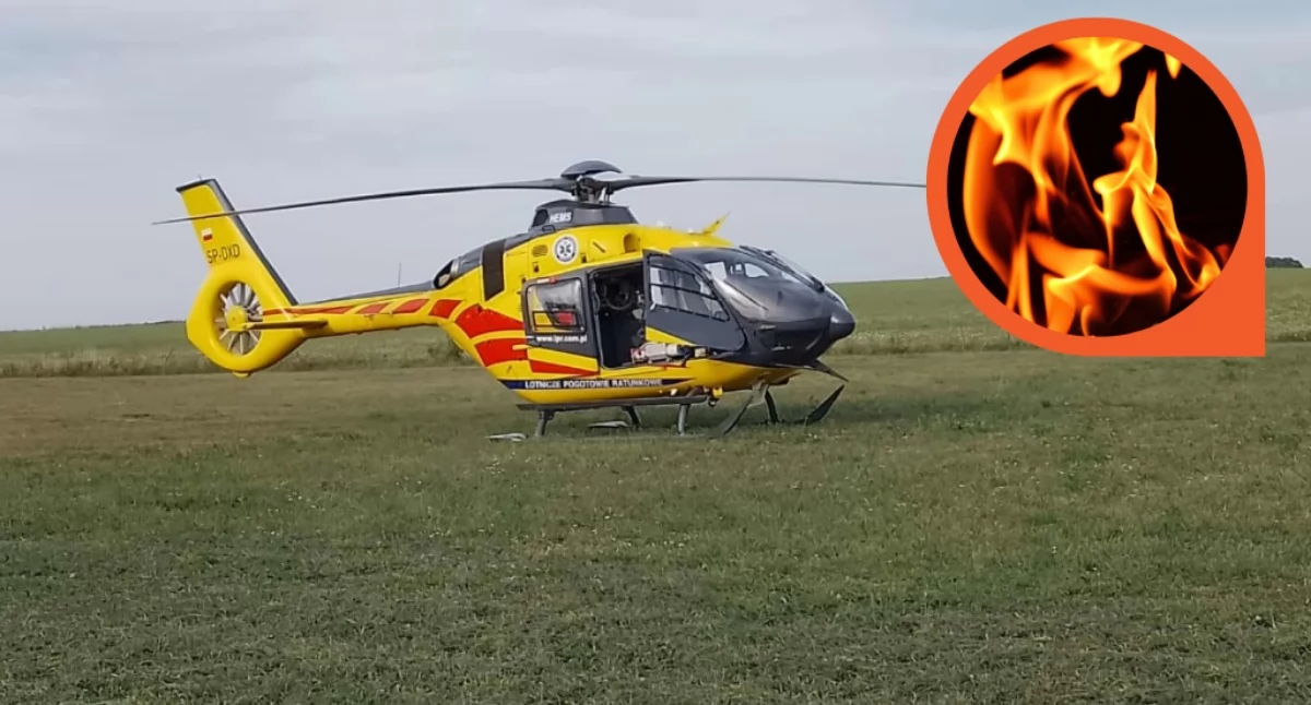 Wypadek przy grillu. 7-letnie dziecko ciężko ranne