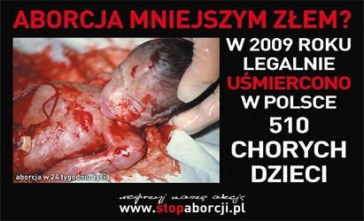 Drastyczne bannery antyaborcyjne na budynku Katolika