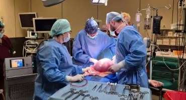 Kobieta nie chodziła na kontrole. Guz jajnika urósł do 15 kilogramów